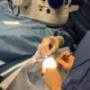La surface oculaire au coeur des préoccupations des chirurgiens ophtalmo
