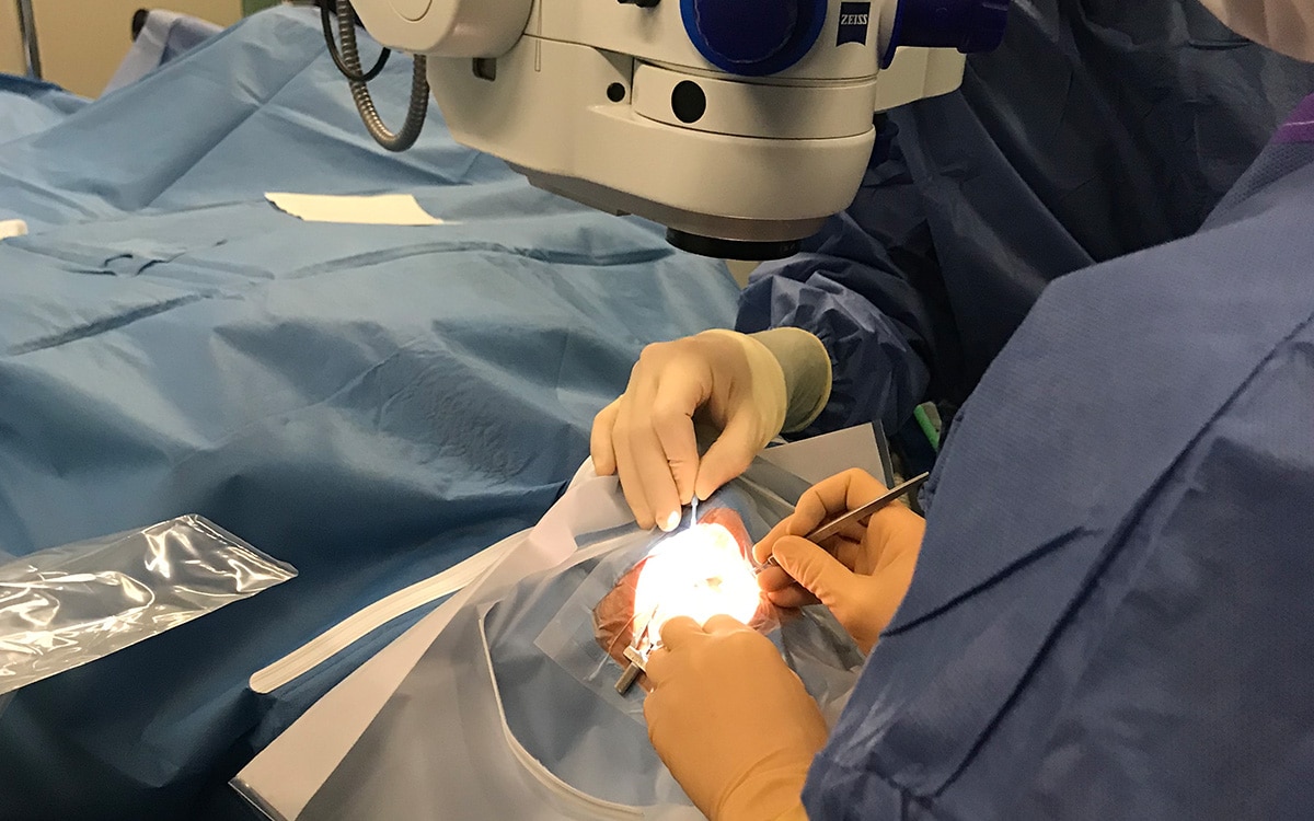 La surface oculaire au coeur des préoccupations des chirurgiens ophtalmo