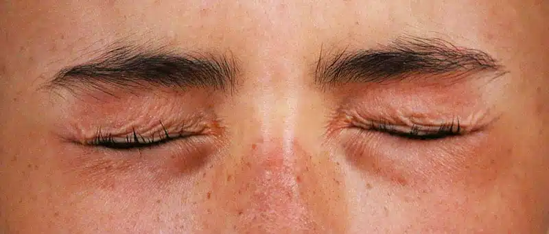 Cligner des yeux pour lutter contre la sécheresse oculaire